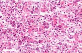 Tipos de células de la adenohipófisis