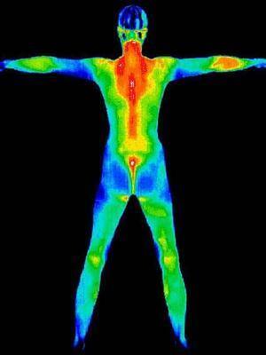 Pérdida de calor corporal