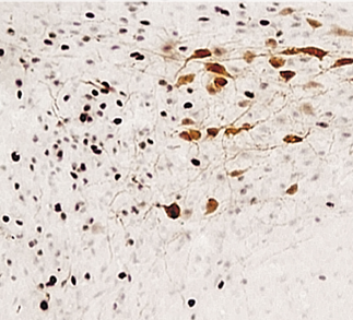 ¿Qué son los osmorreceptores?