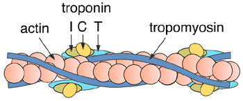 La troponina T (cTnT) y la troponina I cardioespecífica
