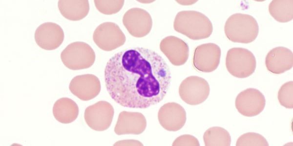 Anaplasmosis granulocitotrópica de seres humanos