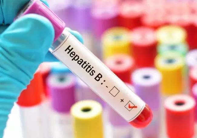 Detección de hepatitis B en embarazadas