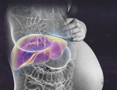 Hígado graso agudo del embarazo