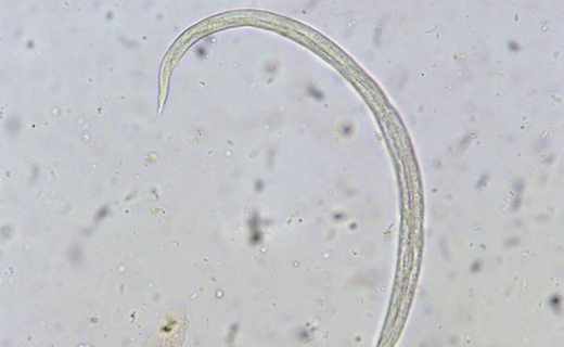 ¿Qué es la angioestrongilosis?