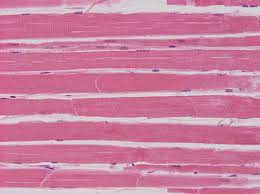 ¿Qué es la rabdomiólisis?