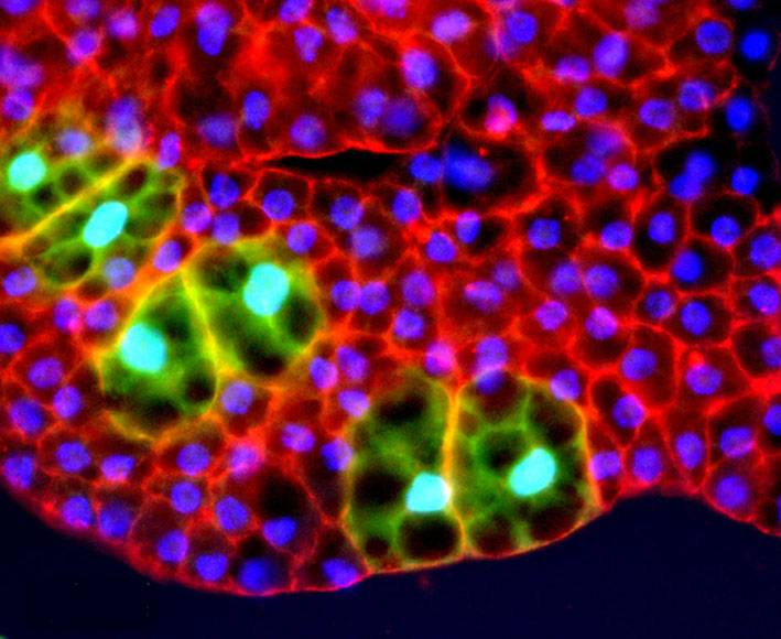 Adaptaciones de las células ante el estrés