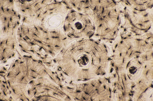 ¿Qué distingue al tejido óseo de otros tejidos conjuntivos?