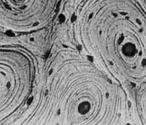 ¿Qué distingue al tejido óseo de otros tejidos conjuntivos?