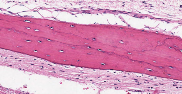 Proteínas no colágenas que se encuentran en la matriz ósea