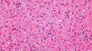 Hepatocitos, las células especializadas del hígado.