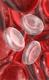 anemia microcítica hipocrómica
