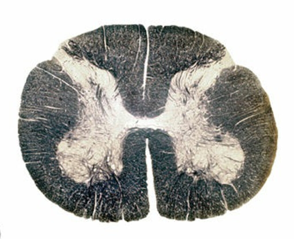 caras de la médula espinal
