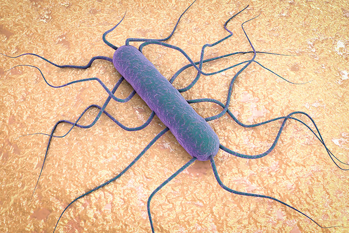 Listeriosis: ¿Cuáles son las manifestaciones clínicas?