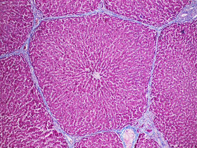 Unidad estructural y funcional del hígado