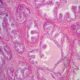 Histología de la Próstata