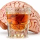 Efectos crónicos de alcohol sobre el sistema nervioso