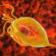Tricomoniasis, infección por Trichomonas vaginalis