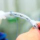 Complicaciones de la intubación endotraqueal