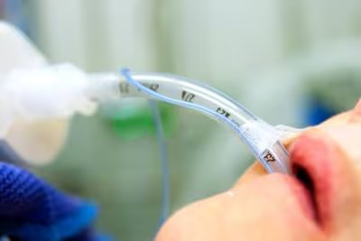 Complicaciones de la intubación endotraqueal