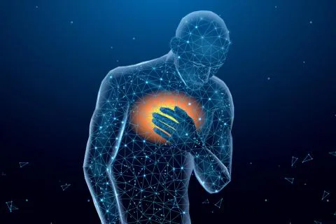 ¿Qué es el síndrome coronario agudo?