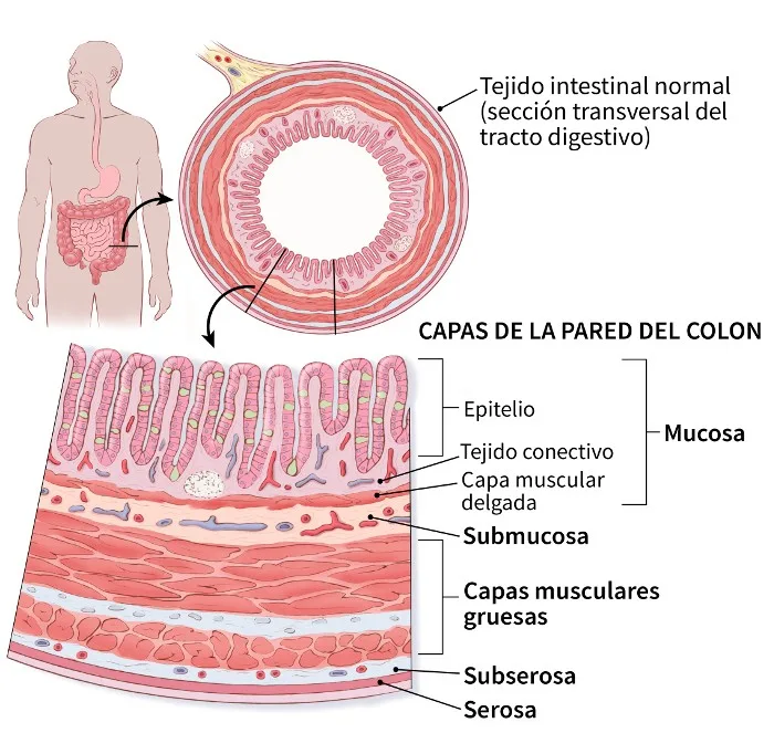 Capas de la pared del intestino grueso