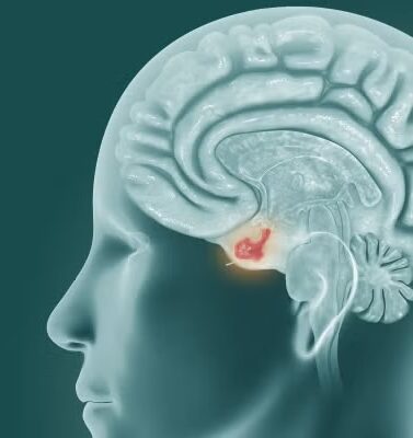 Tumores selares y supraselares