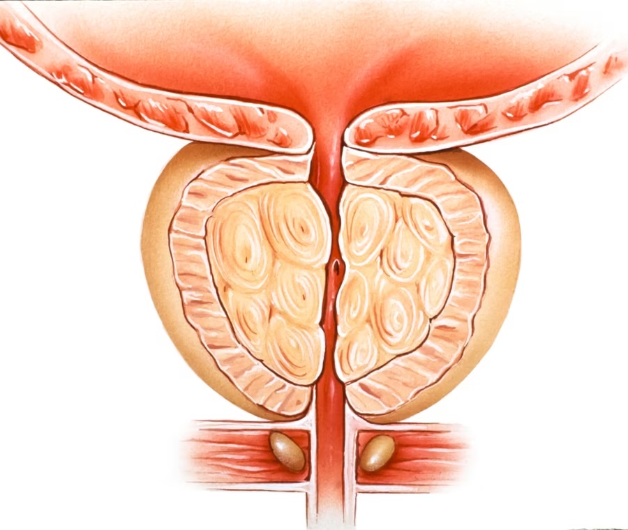 Anatomía del parénquima prostático