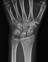 Anatomía de la articulación radiocarpiana