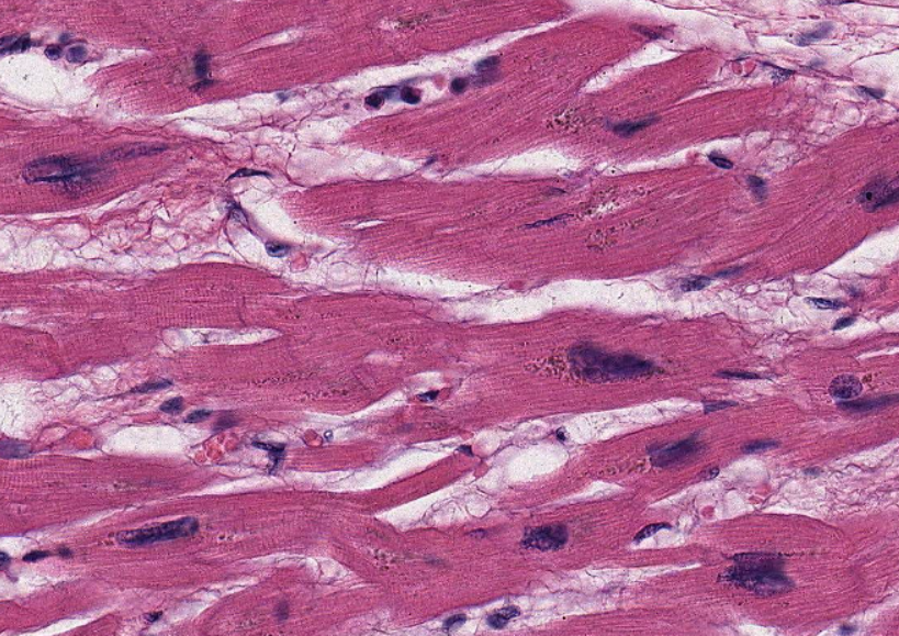 Tratamiento de la rabdomiólisis