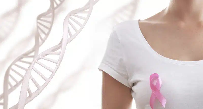 ¿Qué es Oncotype DX?