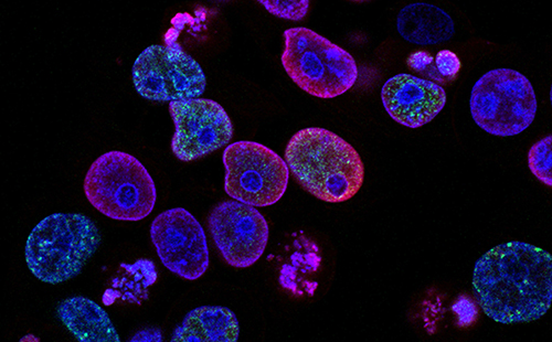 Regeneración de órganos con capacidad regenerativa baja