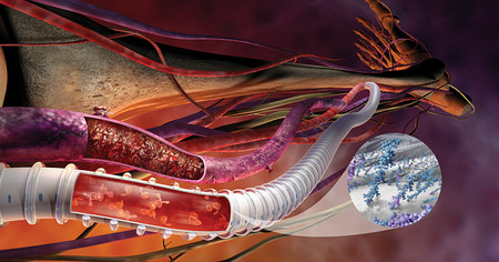 ¿Qué es la ingeniería de tejidos?