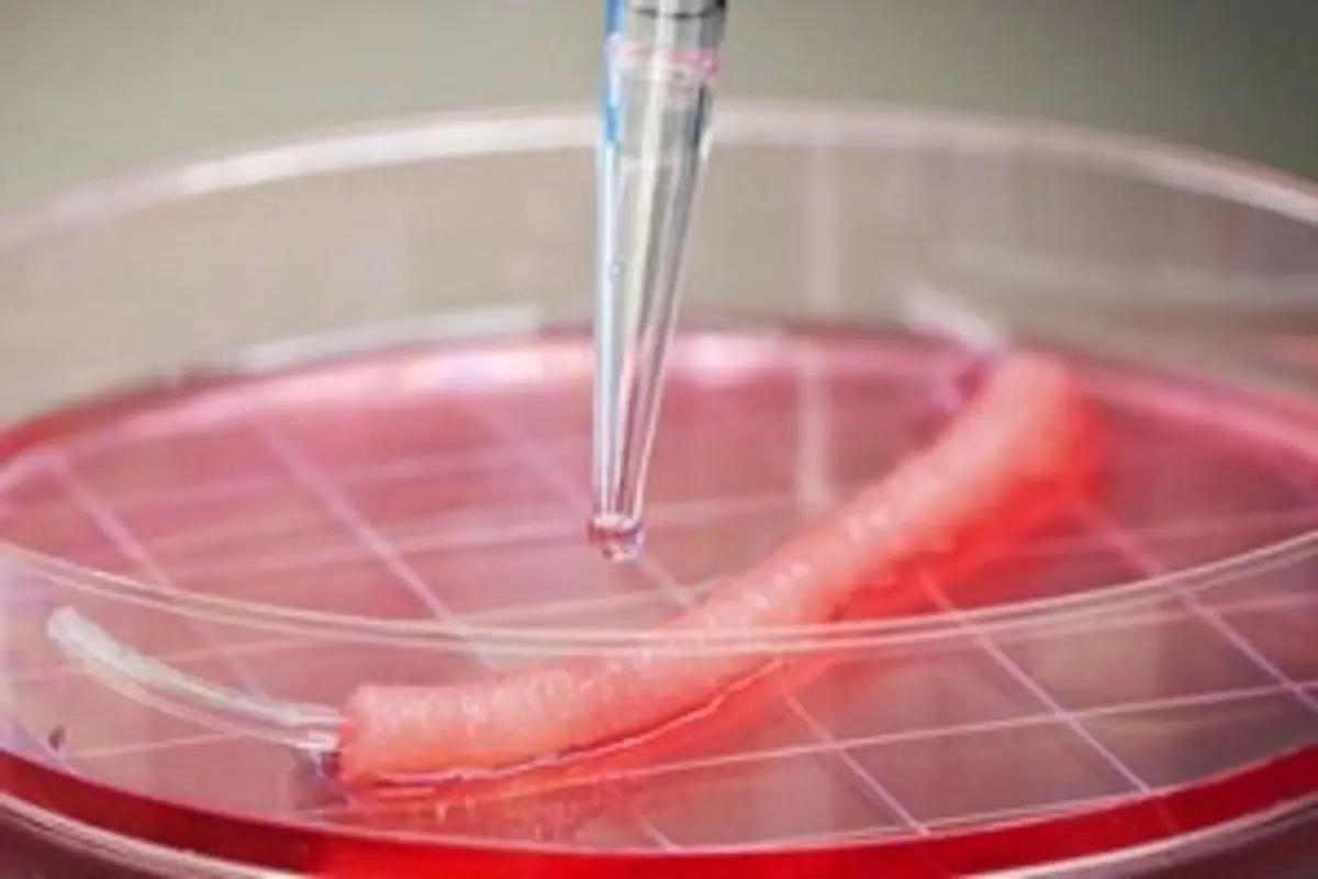 ¿Qué es la ingeniería de tejidos?