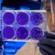 Transplante de células madre pluripotenciales inducidas