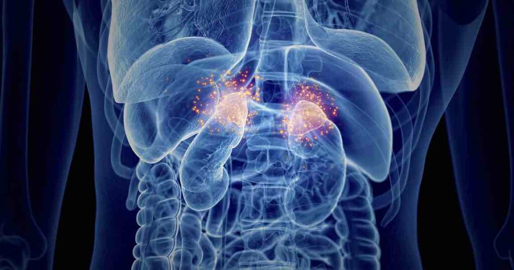Alteraciones del cortisol en la insuficiencia suprarrenal