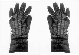 ¿Quién popularizó los guantes en la práctica quirúrgica?