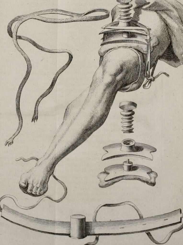 ¿Quién inventó el torniquete?