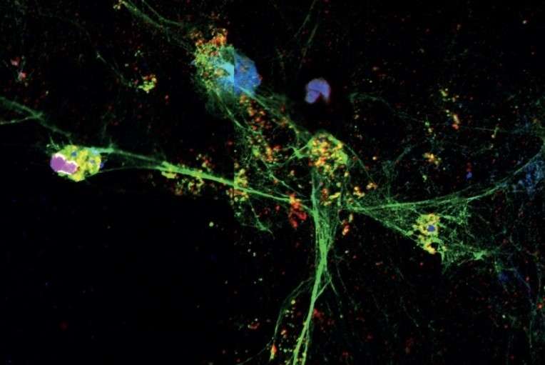 ¿Qué es una trampa extracelular de neutrófilos?