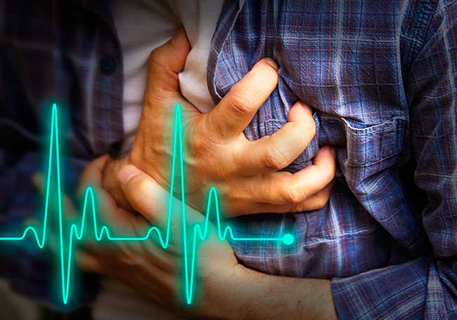 Terapia fibrinolítica en infarto con elevación de ST