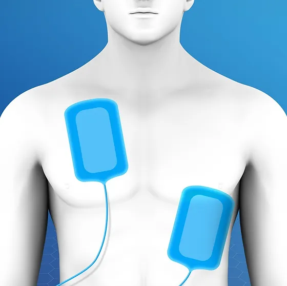 ¿Cuáles son las modalidades para cardioversión electiva?