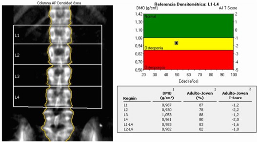 ¿Cuál es la utilidad de la absorciometría de rayos X dual?