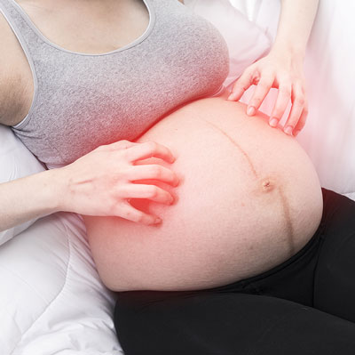 ¿Qué es la colestasis intrahepática del embarazo?