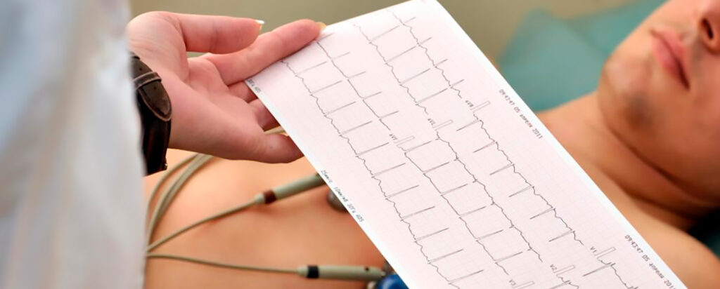 Utilidad del electrocardiograma en pacientes con dolor torácico agudo