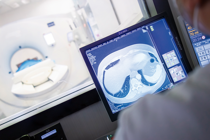 Pruebas diagnósticas en pacientes con hemoptisis