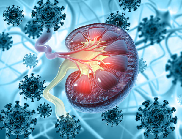 Nefropatía asociada al virus de la inmunodeficiencia humana