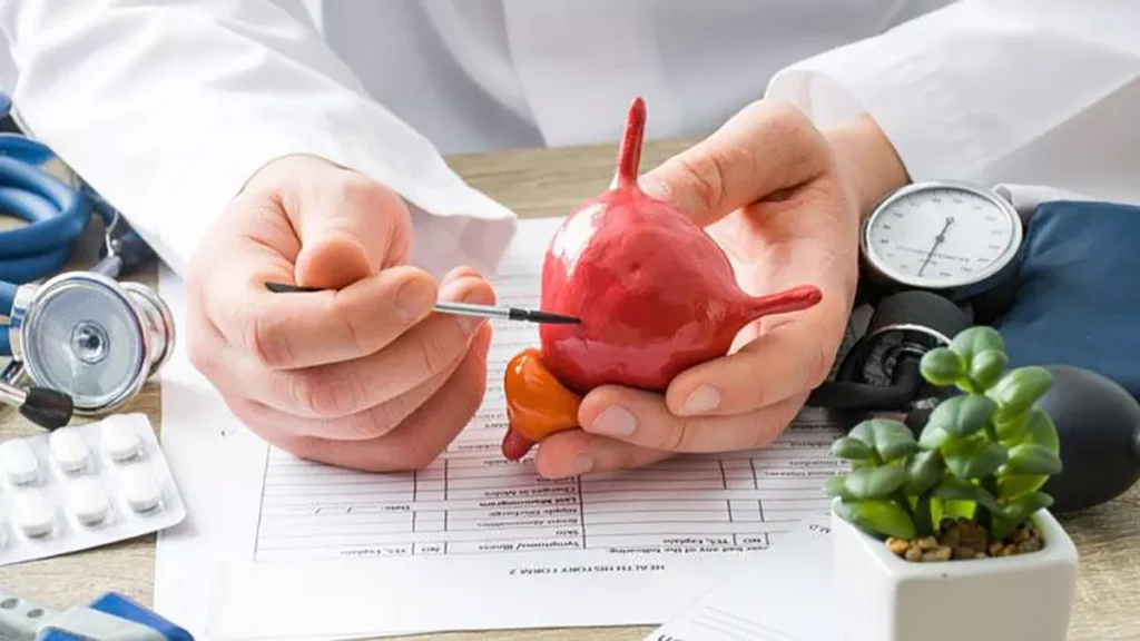 Tratamiento de la incontinencia urinaria por rebosamiento