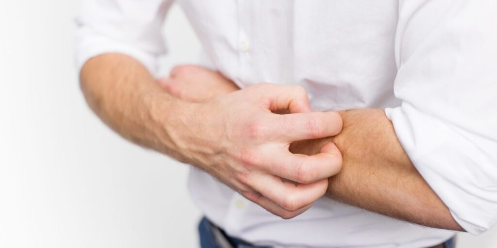 Manifestaciones clínicas de la sarna