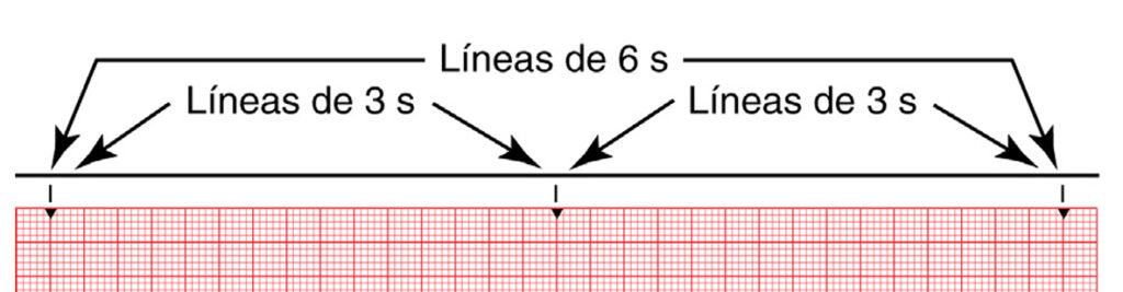 ¿Cuáles son las líneas de tiempo del electrocardiograma?