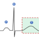 ¿Qué representa la onda T del electrocardiograma?