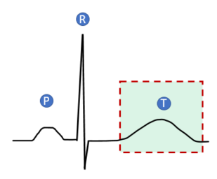 ¿Qué representa la onda T del electrocardiograma?